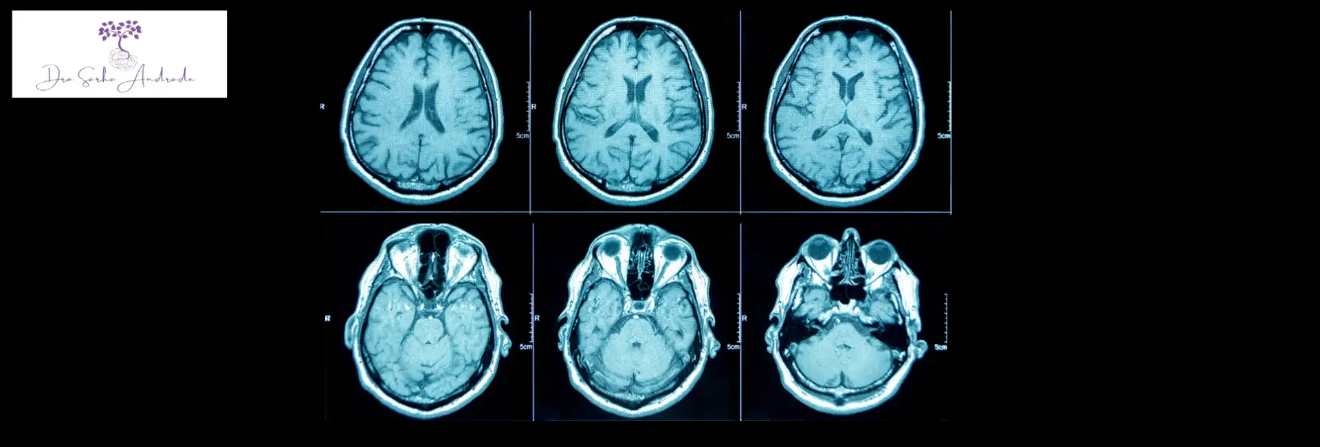 Diagnóstico de Alzheimer